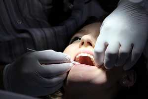 protinių dantų rovimas